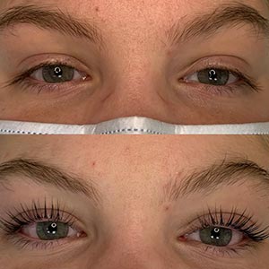 Before and After Image of Lash Lift at Noor Laser Center in Catonsville MD Before and After Image of Lash Lift at Noor Laser Center in Catonsville MD