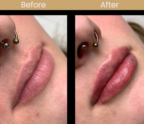 Before and After Images of Noor Laser Center Before and After Images of Noor Laser Center