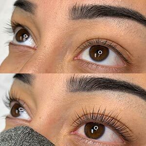 Before and After Image of Lash Lift at Noor Laser Center in Catonsville MD Before and After Image of Lash Lift at Noor Laser Center in Catonsville MD