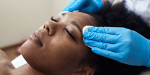 The Perfect Derma Peel Treatment Near Me in Catonsville and Columbia MD