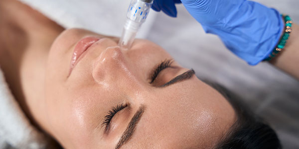 SkinPen Microneedling Specialist Near Me in Columbia and Catonsville MD