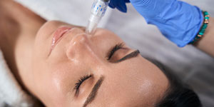 SkinPen Microneedling Specialist Near Me in Columbia and Catonsville MD