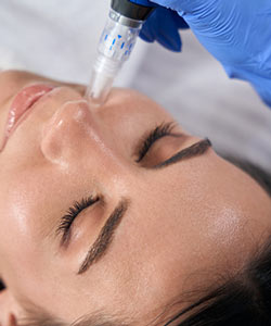 Skin Pen Microneedling Near Me in Columbia and Catonsville, MD