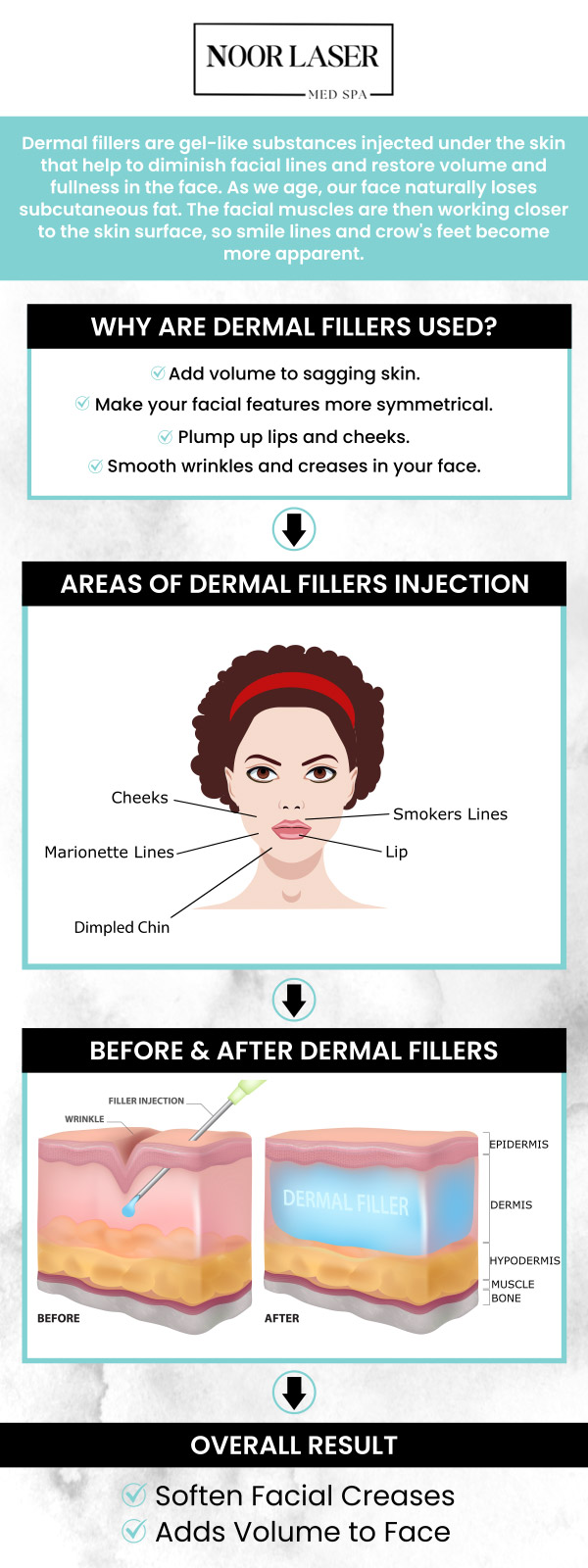 With dermal fillers, you may seem smoother and younger by adding volume to your face and plumping up wrinkles. To find out if dermal fillers are correct for you, it's crucial to speak with a licensed medical professional. Dermal fillers are offered at Noor Laser Center by Emily, RN, and Leila, RN, to address wrinkles, sagging skin, acne scars, and loss of facial volume. For more information, contact us or request an appointment online. We have convenient locations to serve you in Columbia and Catonsville, MD. With dermal fillers, you may seem smoother and younger by adding volume to your face and plumping up wrinkles. To find out if dermal fillers are correct for you, it's crucial to speak with a licensed medical professional. Dermal fillers are offered at Noor Laser Center by Emily, RN, and Leila, RN, to address wrinkles, sagging skin, acne scars, and loss of facial volume. For more information, contact us or request an appointment online. We have convenient locations to serve you in Columbia and Catonsville, MD.