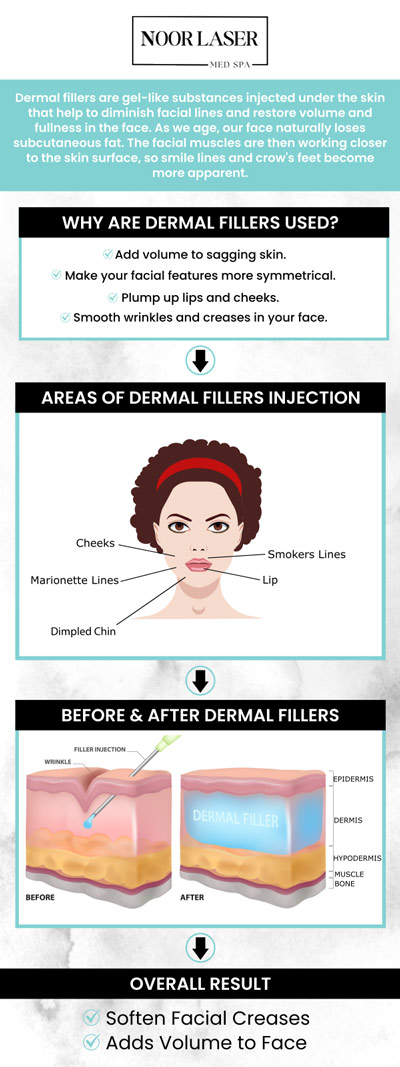 With dermal fillers, you may seem smoother and younger by adding volume to your face and plumping up wrinkles. To find out if dermal fillers are correct for you, it's crucial to speak with a licensed medical professional. Dermal fillers are offered at Noor Laser Center by Emily, RN, and Leila, RN, to address wrinkles, sagging skin, acne scars, and loss of facial volume. For more information, contact us or request an appointment online. We have convenient locations to serve you in Columbia and Catonsville, MD. With dermal fillers, you may seem smoother and younger by adding volume to your face and plumping up wrinkles. To find out if dermal fillers are correct for you, it's crucial to speak with a licensed medical professional. Dermal fillers are offered at Noor Laser Center by Emily, RN, and Leila, RN, to address wrinkles, sagging skin, acne scars, and loss of facial volume. For more information, contact us or request an appointment online. We have convenient locations to serve you in Columbia and Catonsville, MD.