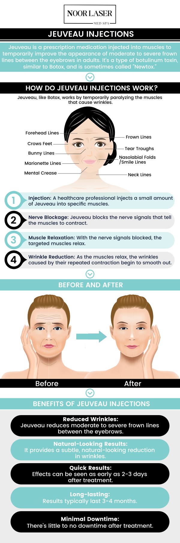 Common questions asked by clients: What is Jeuveau and how does it work for wrinkle reduction? How is Jeuveau different from Botox and other neuromodulators? How long do the effects of Jeuveau typically last? What areas of the face can be treated with Jeuveau? For more information, contact us today or book an appointment online. We have convenient locations to serve you in Catonsville and Columbia, MD. We serve clients from Catonsville MD, Columbia MD, Ellicott City MD, Clarksville MD, Fulton MD, Baltimore MD, Pikesville MD, Woodbine MD, and the surrounding areas.