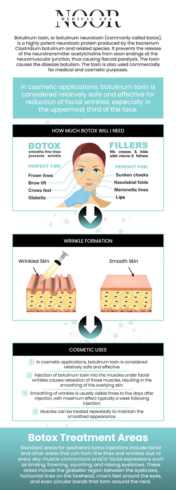As we age, our skin changes, including wrinkles and folds, which diminish the natural volume of youthful skin. Botox, an FDA-approved non-surgical procedure, can effectively reduce or eliminate facial wrinkles like forehead lines, frown lines, and crow's feet without the need for surgery or scarring, offering a fresh, rejuvenating appearance. If you have questions about the Botox treatment, consult Dr. Nasser Nasseri, MD, and his staff at Noor Medical Spa. For more information, contact us or schedule an appointment online. We are conveniently located at 700 Geipe Road Suite 100 Catonsville, MD 21228. As we age, our skin changes, including wrinkles and folds, which diminish the natural volume of youthful skin. Botox, an FDA-approved non-surgical procedure, can effectively reduce or eliminate facial wrinkles like forehead lines, frown lines, and crow's feet without the need for surgery or scarring, offering a fresh, rejuvenating appearance. If you have questions about the Botox treatment, consult Dr. Nasser Nasseri, MD, and his staff at Noor Medical Spa. For more information, contact us or schedule an appointment online. We are conveniently located at 700 Geipe Road Suite 100 Catonsville, MD 21228.