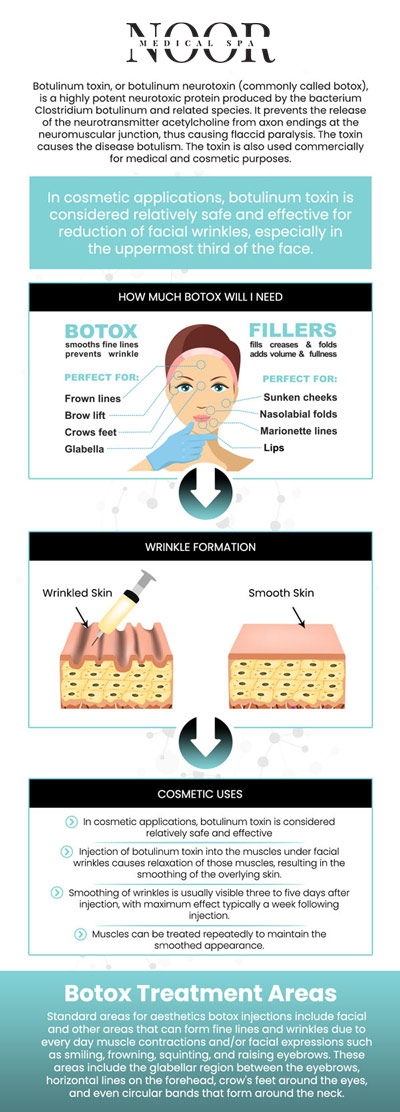 Botox therapy is a safe and effective procedure that uses pure botulinum toxin to temporarily relax facial muscles, erasing wrinkles and fine lines with minimum downtime. Botox is a widely accepted and FDA-approved cosmetic surgery that produces noticeable, natural-looking effects. Botox is available at Noor Medical Spa. Botox is administered by our experienced professionals. For more information, contact us or request an appointment online. We are conveniently located at 700 Geipe Road Suite 100 Catonsville, MD 21228. 