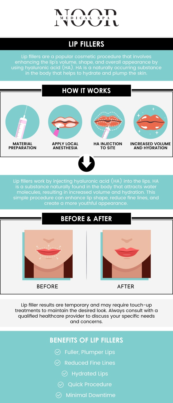 Lip fillers help restore lost volume or correct asymmetry, creating a more youthful and harmonious look. This subtle enhancement not only improves the appearance of the lips but also enhances the overall smile, giving it a fuller and more appealing appearance. Dr. Nasser Nasseri, M.D., offers lip filler treatment that adds volume, making the lips appear smoother, softer, and more defined, resulting in a more confident and radiant smile. Contact us for more information or schedule your online consultation. We are conveniently located at 700 Geipe Road Suite 100 Catonsville, MD 21228.