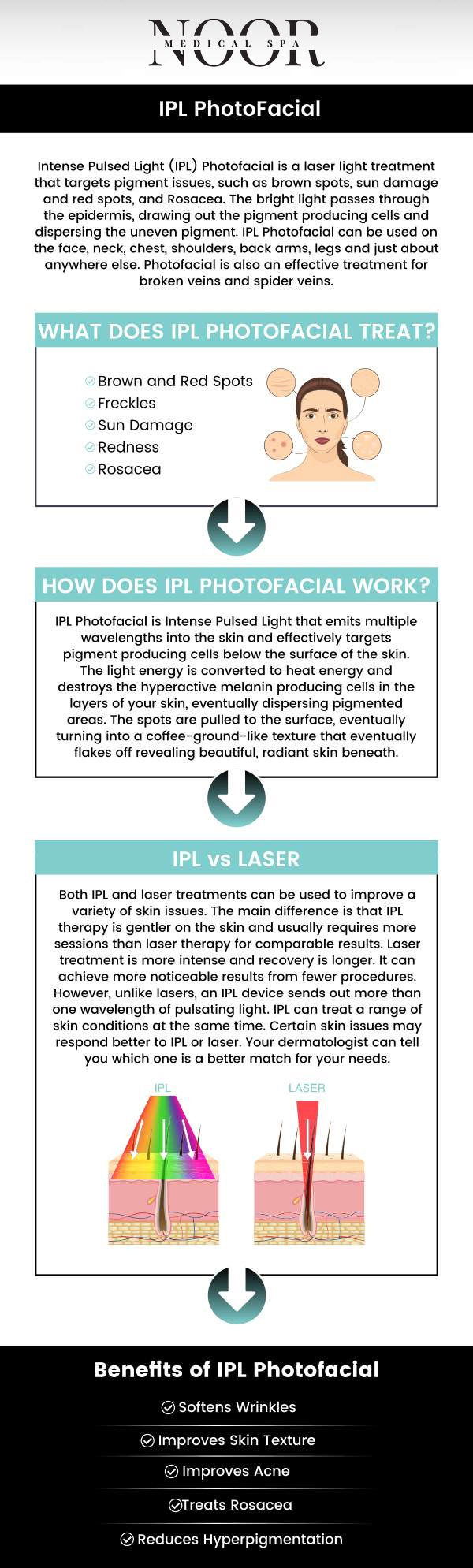 IPL (Intense Pulsed Light) photofacial treatment is a popular non-invasive skin rejuvenation procedure that uses light energy to address a wide range of skin concerns. IPL technology is effective in treating various skin issues, including sun damage, hyperpigmentation, acne scars, rosacea, and facial veins. IPL Photofacial treatment is an ideal choice if you want to revitalize your skin and give it a more youthful tone and smoothness. At Noor Medical Spa, Dr. Nasser Nasseri, M.D., offers IPL Photofacials. For more information, contact us today or book an appointment online. We are conveniently located at 700 Geipe Road Suite 100 Catonsville, MD 21228. IPL (Intense Pulsed Light) photofacial treatment is a popular non-invasive skin rejuvenation procedure that uses light energy to address a wide range of skin concerns. IPL technology is effective in treating various skin issues, including sun damage, hyperpigmentation, acne scars, rosacea, and facial veins. IPL Photofacial treatment is an ideal choice if you want to revitalize your skin and give it a more youthful tone and smoothness. At Noor Medical Spa, Dr. Nasser Nasseri, M.D., offers IPL Photofacials. For more information, contact us today or book an appointment online. We are conveniently located at 700 Geipe Road Suite 100 Catonsville, MD 21228.