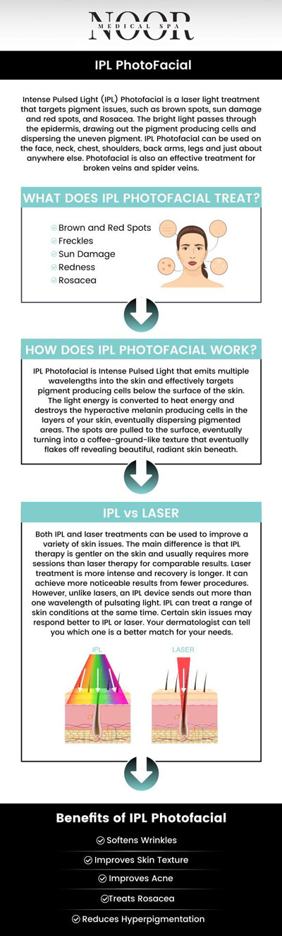 IPL Photofacial is a non-invasive treatment that uses intense pulsed light to target skin imperfections, promoting a clearer, smoother, and more youthful appearance. Achieve radiant skin with IPL Photofacial Treatments by consulting Dr. Nasser Nasseri, MD, at Noor Medical Spa. Contact us for more information or schedule your online consultation. We conveniently serve you at 700 Geipe Rd, Suite 100, Catonsville, MD 21228.