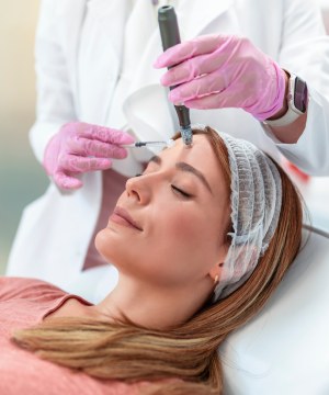 SkinPen Microneedling with PRP Near Me in Catonsville MD